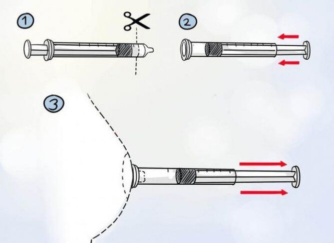 Como afecta un extractor de leite ao tamaño do pezón 