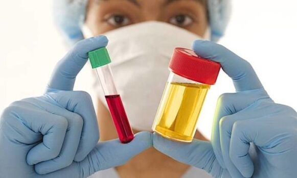 Análise de sangue e orina antes da cirurxía de aumento de mama